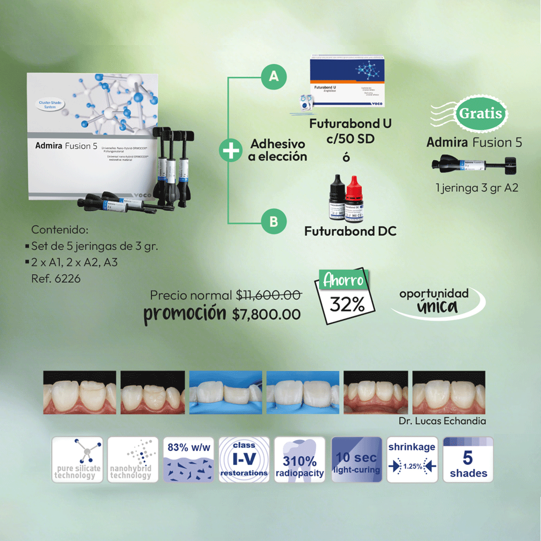 Admira Fusion 5 Set Jeringas 5 X 3 G + Futurabond + Accesorios - producto dental BIGtree