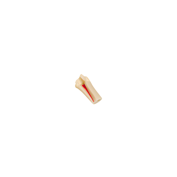 Diente Con Cavidad Y Conducto Para Endo Para Tipodonto de 32 Dientes - producto dental BIGtree