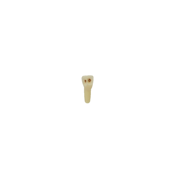 Diente Esmalte-Dentina Con Caries Nueva Version Para Tipodonto de 28 Dientes - producto dental BIGtree