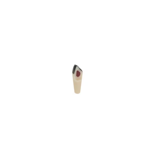 Diente Para Pulpotomia Con Caries Para Tipodonto Infantil - producto dental BIGtree