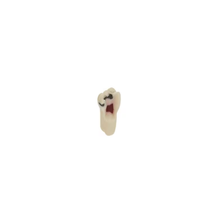 Diente Para Pulpotomia Con Caries Para Tipodonto Infantil