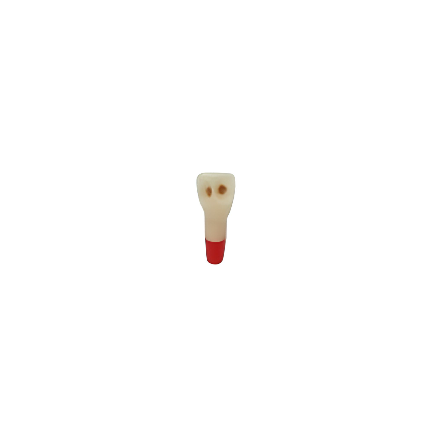 Diente Tres Capas Con Caries Nueva Version Para Tipodonto de 32 Dientes