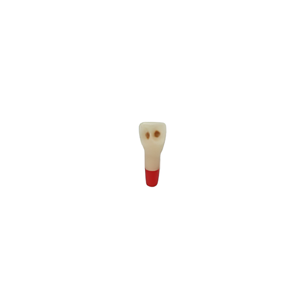 Diente Tres Capas Con Caries Nueva Version Para Tipodonto de 32 Dientes - producto dental BIGtree