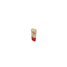 Diente Tres Capas Con Caries Nueva Version Para Tipodonto de 32 Dientes