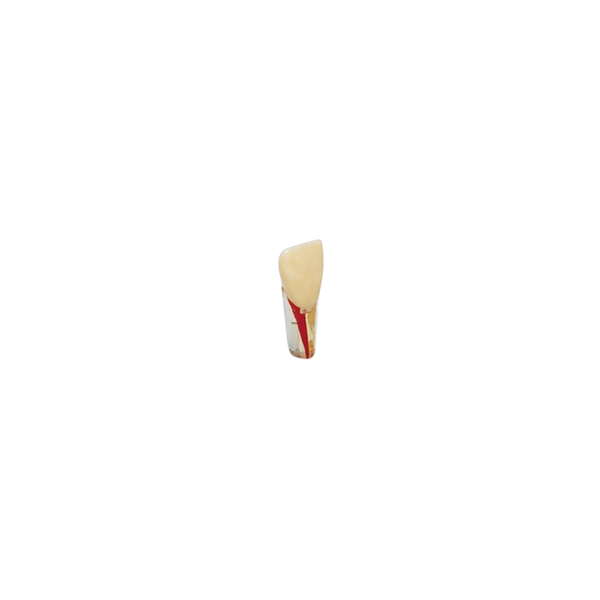 Diente Para Ag-3 Raiz Transparente Para Endo Para Tipodonto de 32 Dientes - producto dental BIGtree