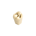 Diente Con Caries En Fisura No 17