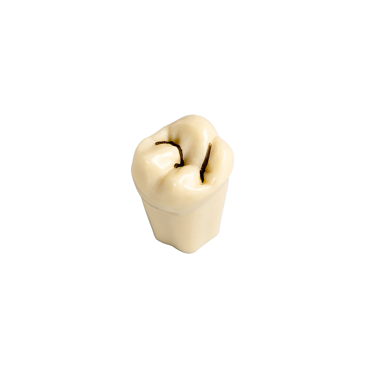 Diente Con Caries En Fisura No 17 - producto dental BIGtree