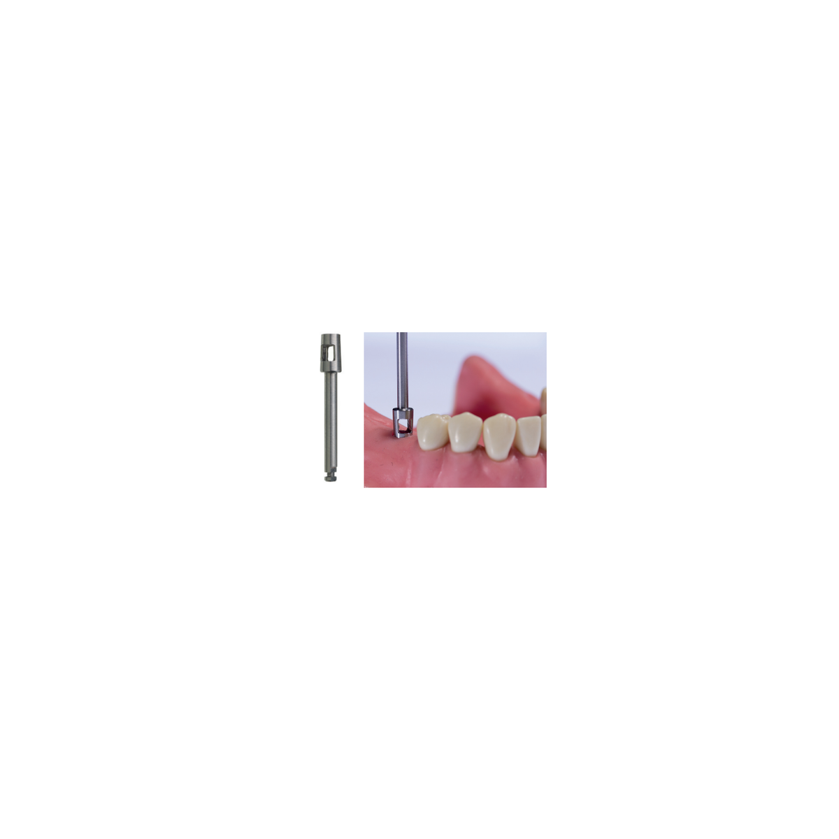 Punches Para Encia Ca 3.50 mm P 71 D - producto dental BIGtree
