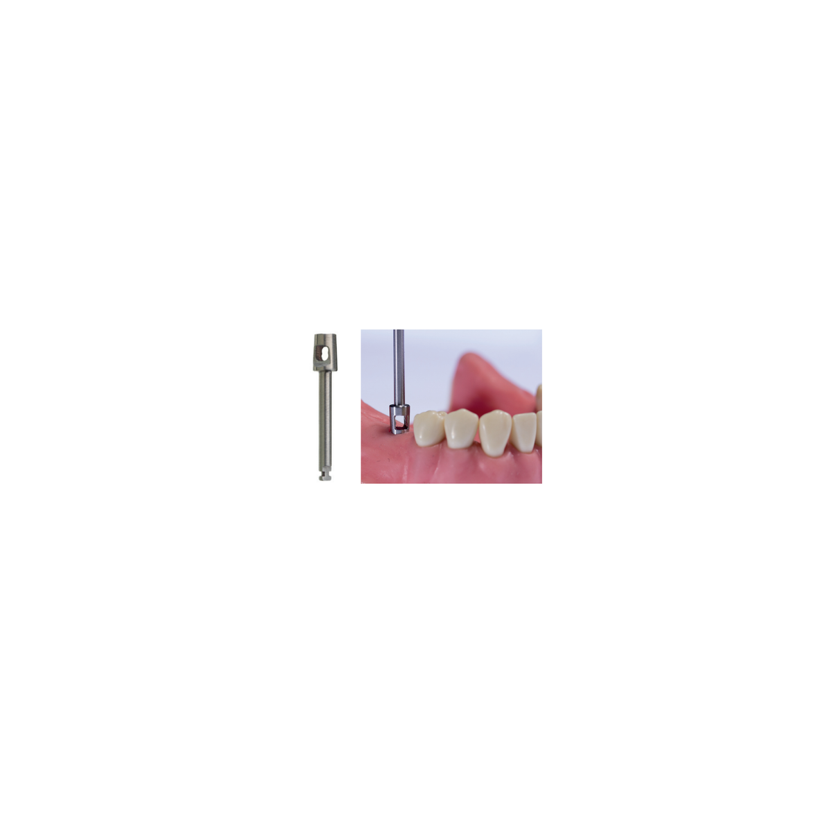Punches Para Encia Ca 4.00 mm P71 D - producto dental BIGtree