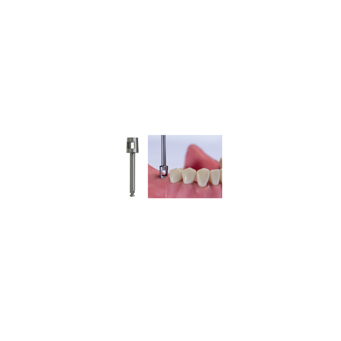 Punches Para Encia Ca 5.00 mm P 71 D