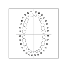 Juego de Dientes 1 X 32 Ag-3