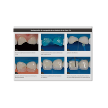 Amaris Set Jeringas 8 X 4 G, Amaris Flow 2 X 1.8 G + Futurabond NR SD + Accesorios