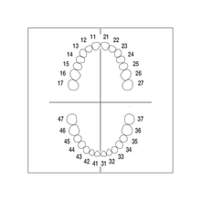 Juego de Diente 1 X 28
